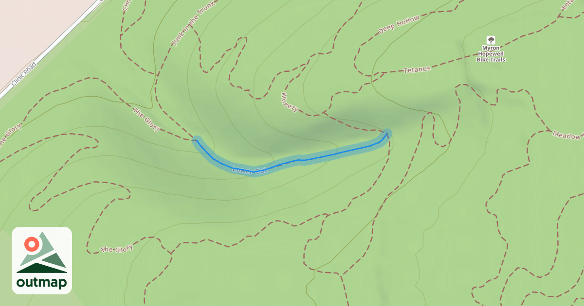 Map of Lower Gut