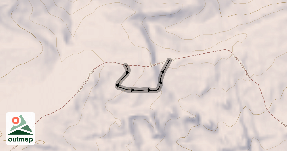 Map of Lower Spinal Tap