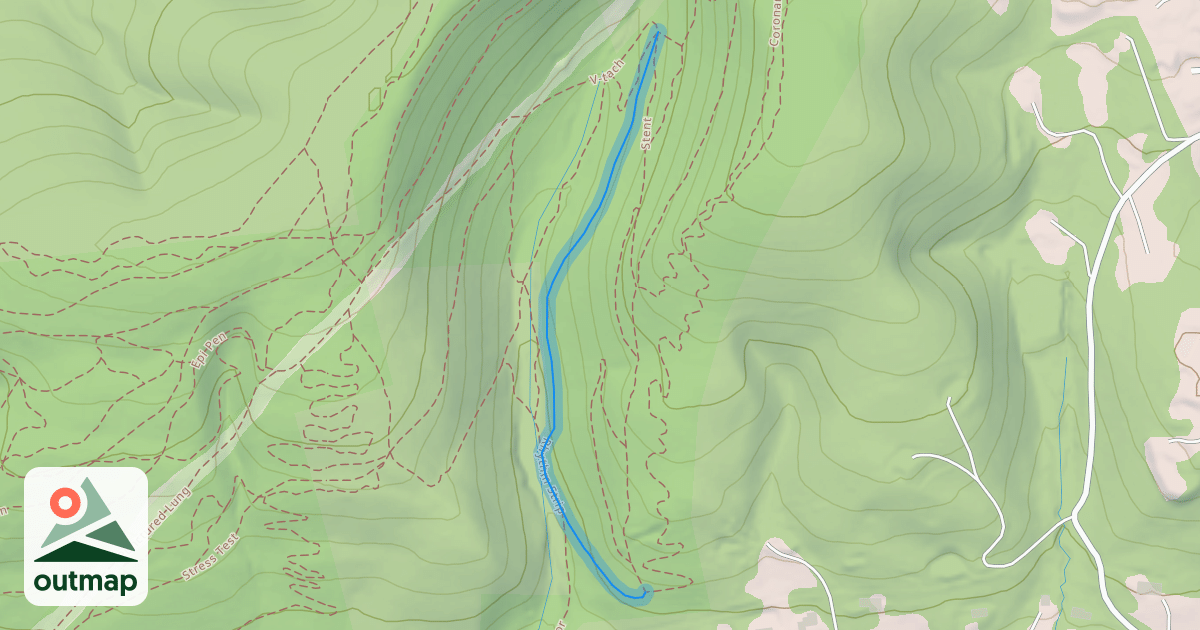 Map of Rhythm Strip