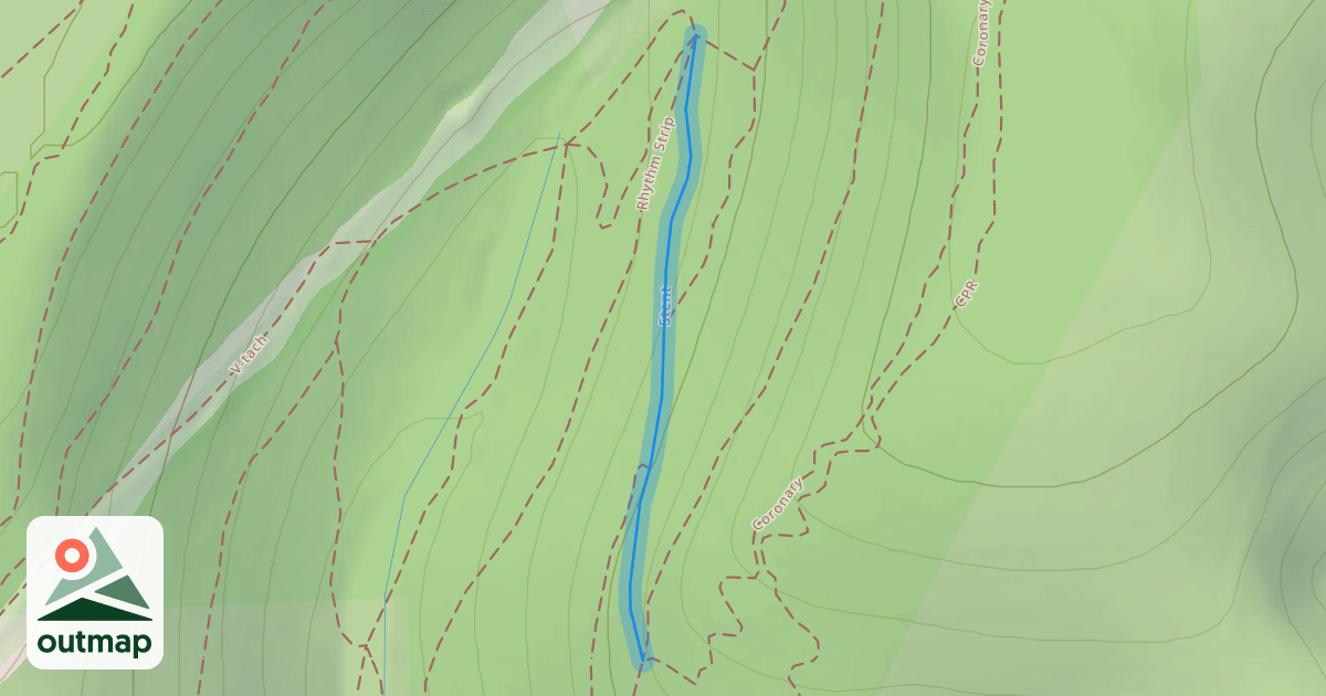 Map of Stent