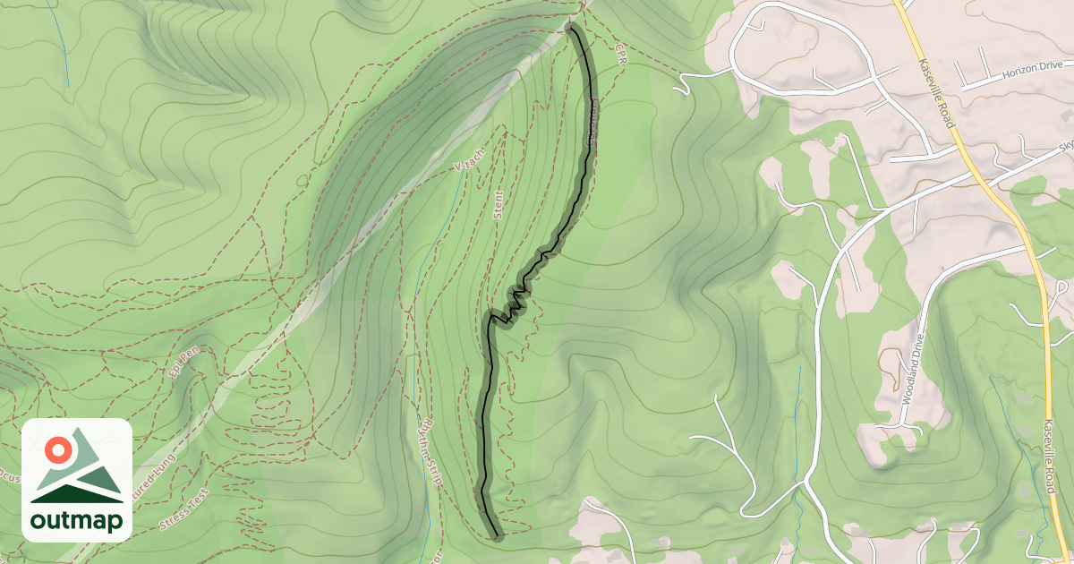Map of Coronary