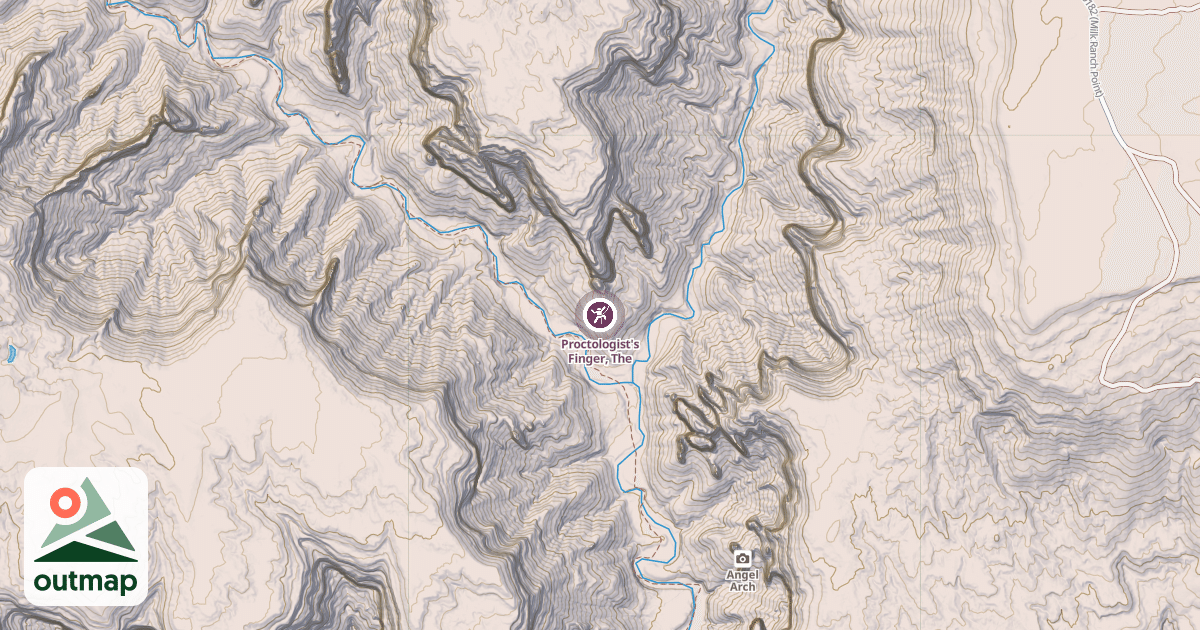 Map of Proctologist's Finger, The