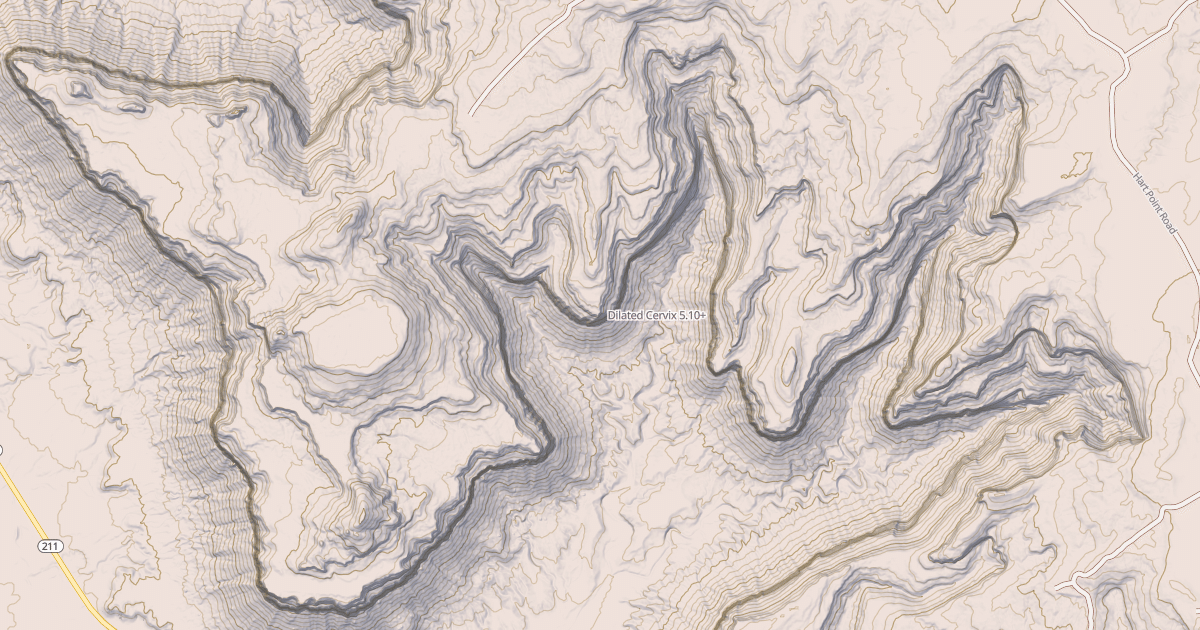 Map preview of Dilated Cervix