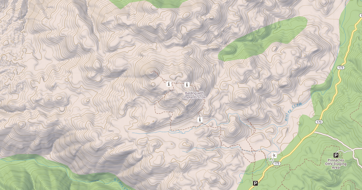 Map preview of Balding with Implants
